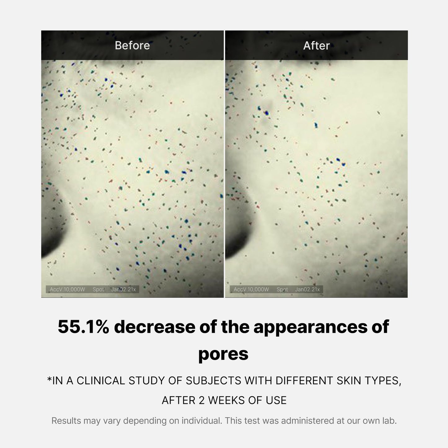 zero-pore-one-day-cream-e3 04_3616addc-f184-4deb-a5d7-e3a782e4713d.jpg