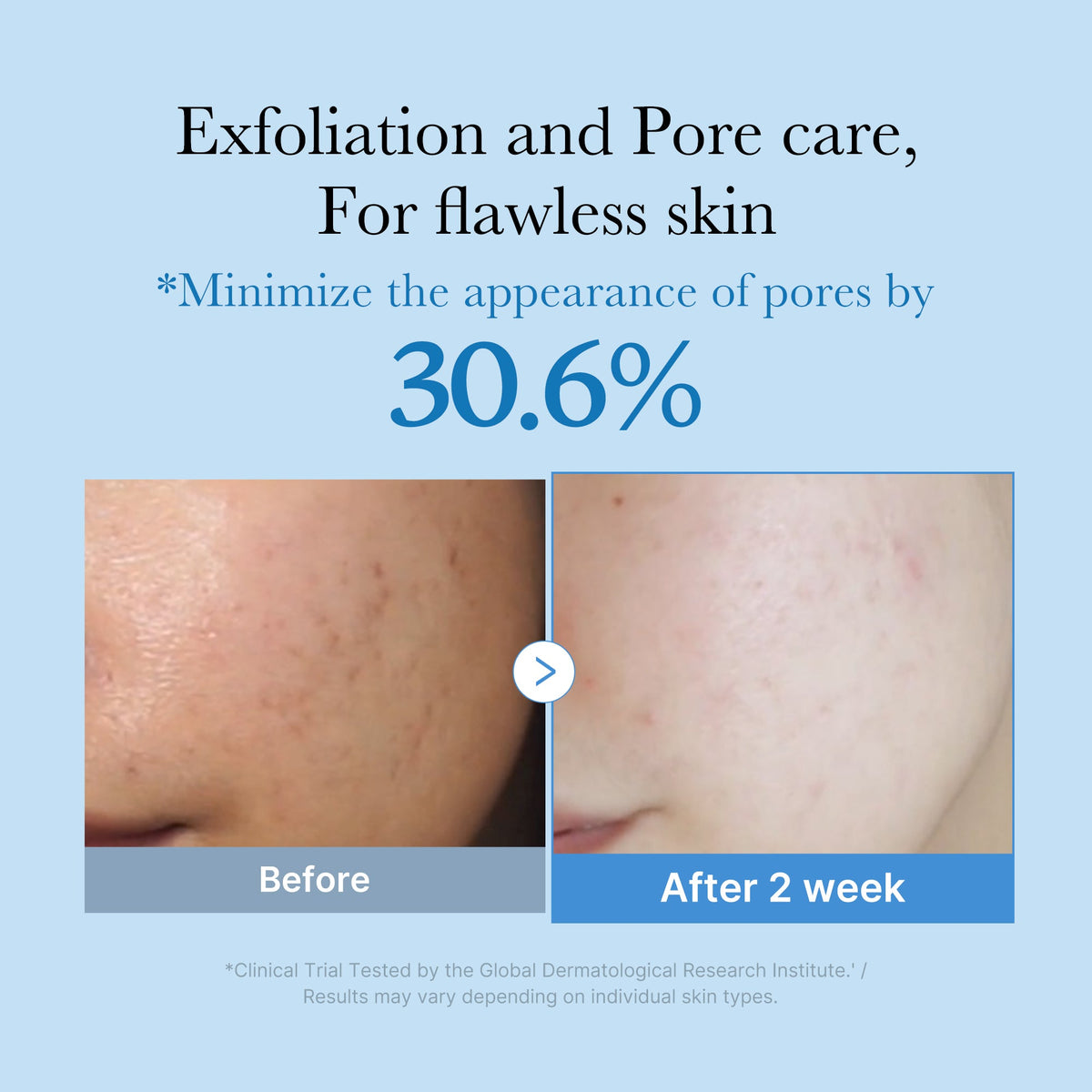 zero-pore-toner-s3 01_d6480b4e-3c08-4954-994a-ed5212c1839c.jpg