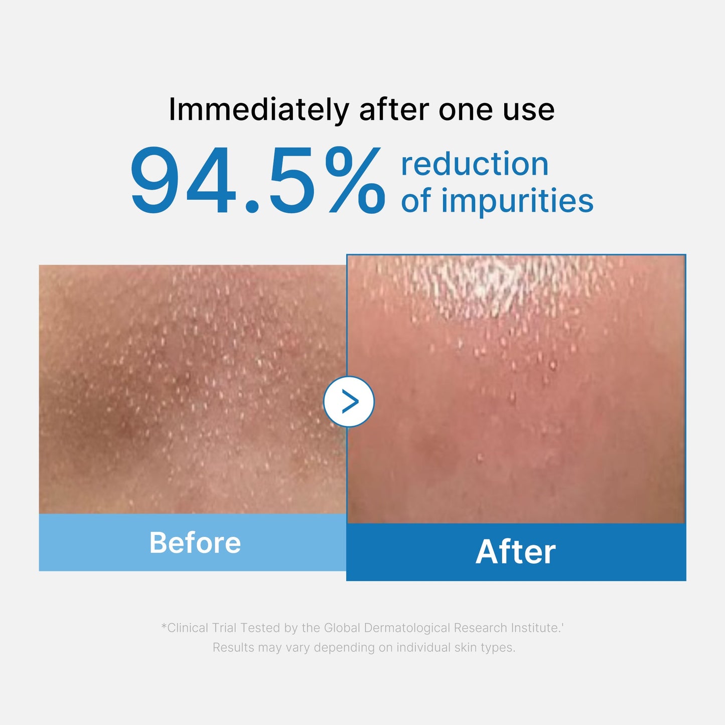 zero-pore-blackhead-deep-cleansing-oil-m6 01_eed557ec-5857-46a2-8b17-dbd67c692dcb.jpg