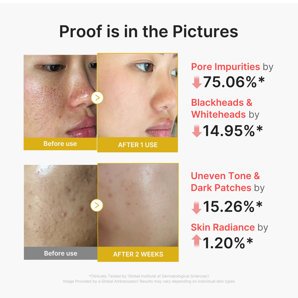 kojic-acid-turmeric-peel-shot-j9 02_45fe66d3-b3f6-4100-aa52-2afd7eded417.jpg