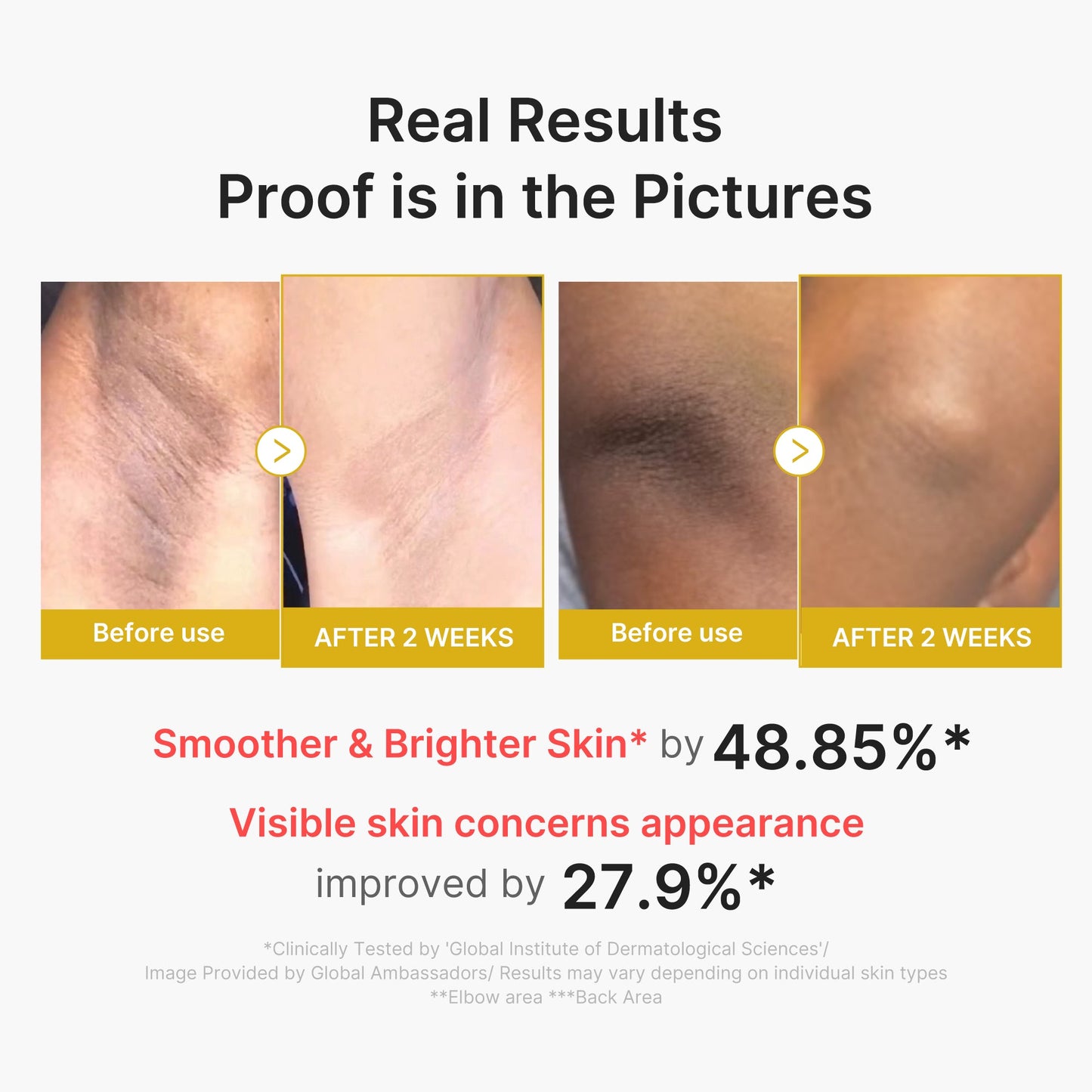 kojic-acid-turmeric-body-peel-shot-p2 02_72880cfc-382b-440b-8152-7e3dce87da2a.jpg