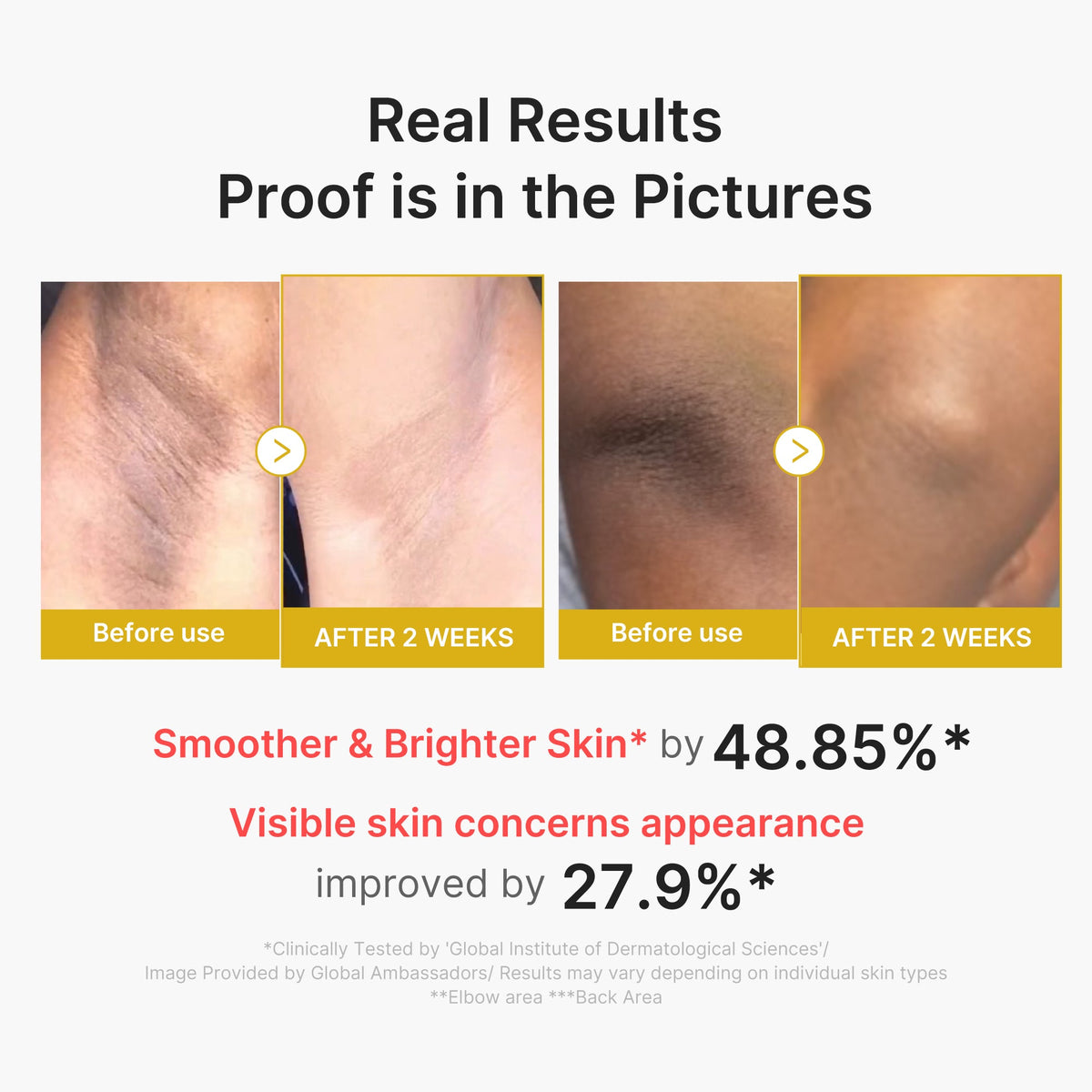 kojic-acid-turmeric-body-peel-shot-p2 02_72880cfc-382b-440b-8152-7e3dce87da2a.jpg