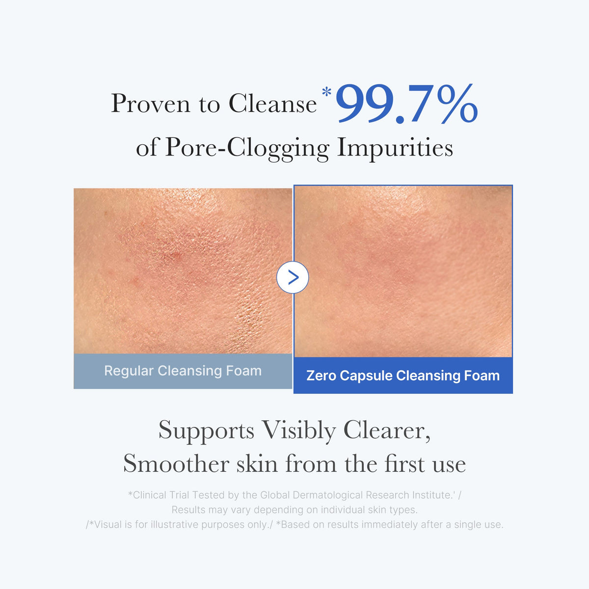 zero-pore-capsule-cleansing-foam-b4 02_c1fb9dfb-86c5-4038-8ff8-490d1006276c.jpg