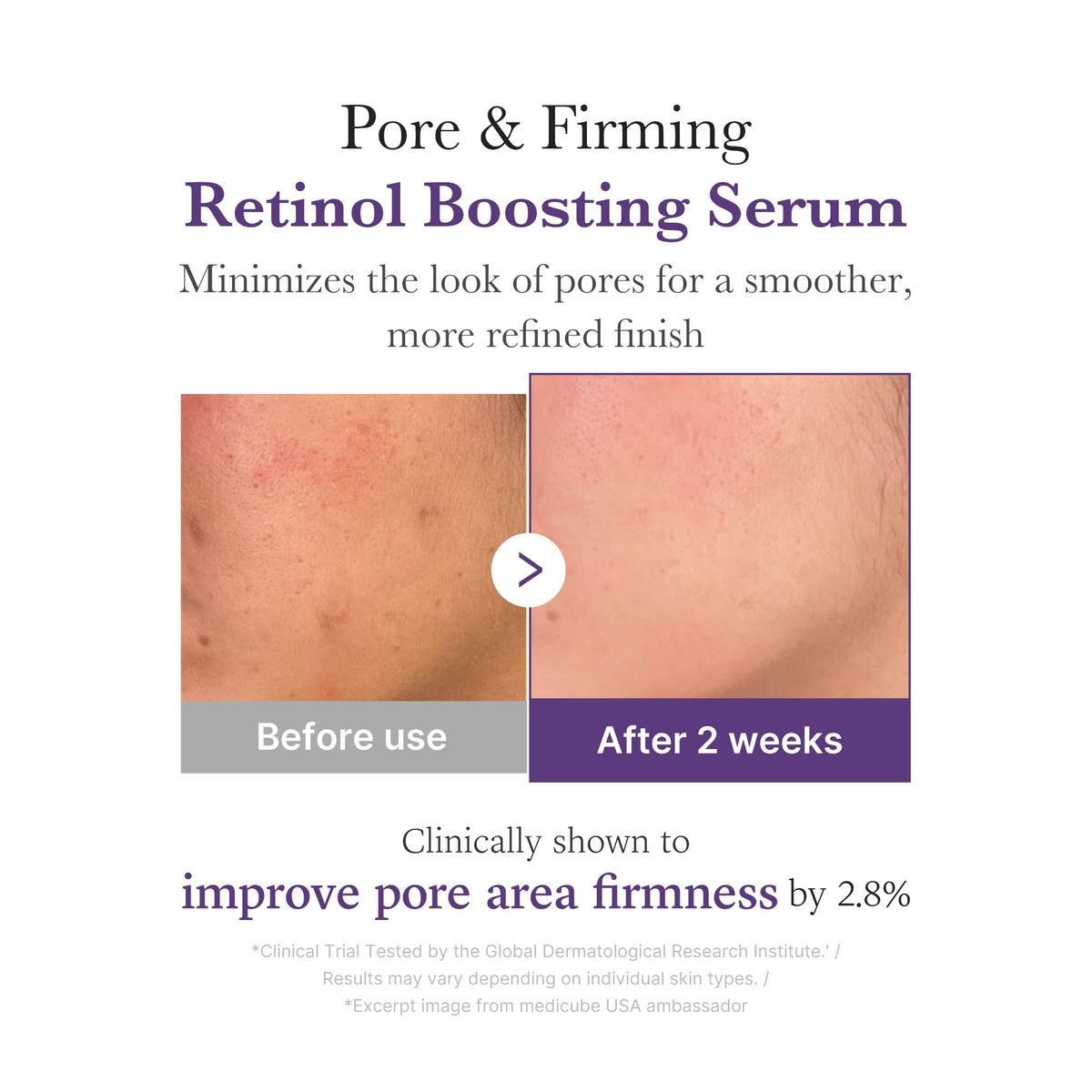 retinol-nmn-boosting-serum-z5 03_3510e7a5-5633-4a18-81ea-1389593bd517.jpg