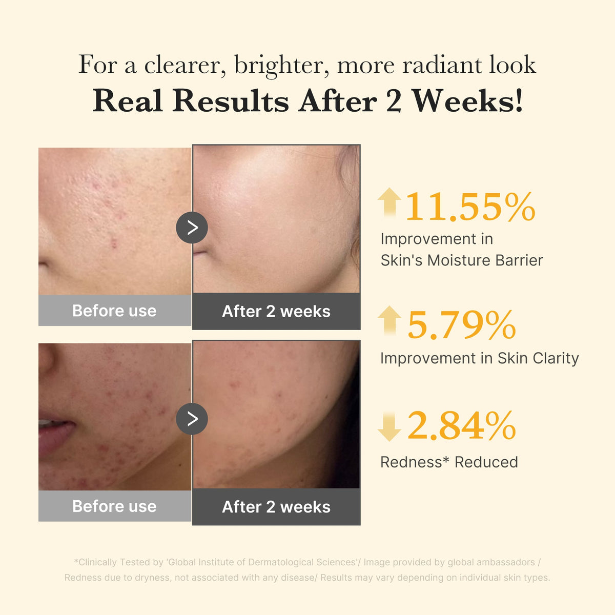 kojic-acid-turmeric-capsule-serum-e3 03_436487f5-76df-490e-8a61-01118373efbd.jpg