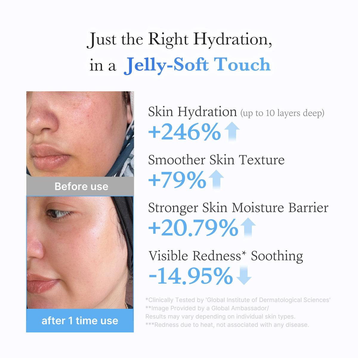 hyaluronic-ceramide-moisturizing-jelly-cream-b2 03_c39d66cc-0839-4e48-ab4a-d32143d06b1c.jpg