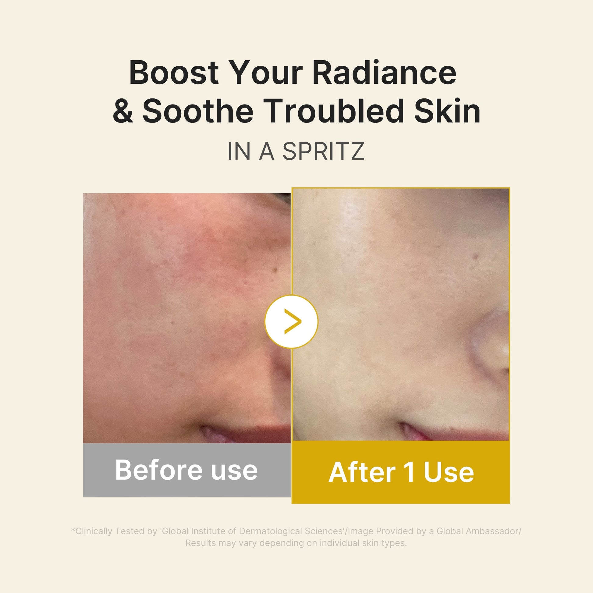 kojic-acid-turmeric-vitamin-gold-jelly-mist-serum-t9 03_dc9cd19e-4e57-49d3-9b66-c7762e8a63f1.jpg