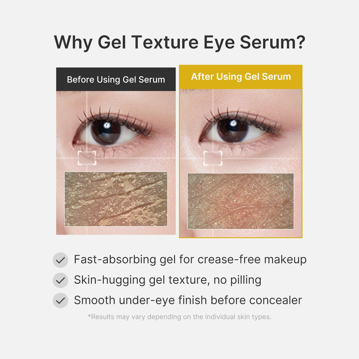 kojic-acid-tumeric-eye-gel-serum-v0 04_0487ef36-49f4-4294-8049-bb55118b05fe.jpg