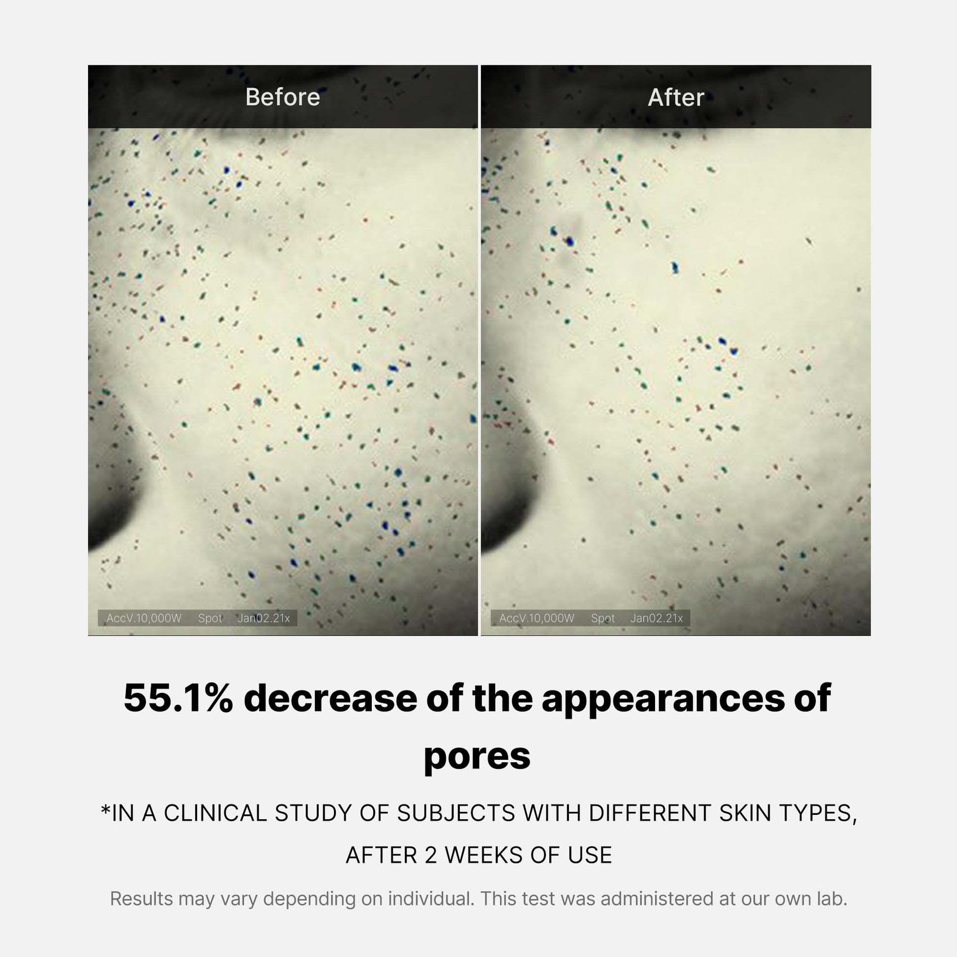 zero-pore-one-day-cream-e3 04_3616addc-f184-4deb-a5d7-e3a782e4713d.jpg
