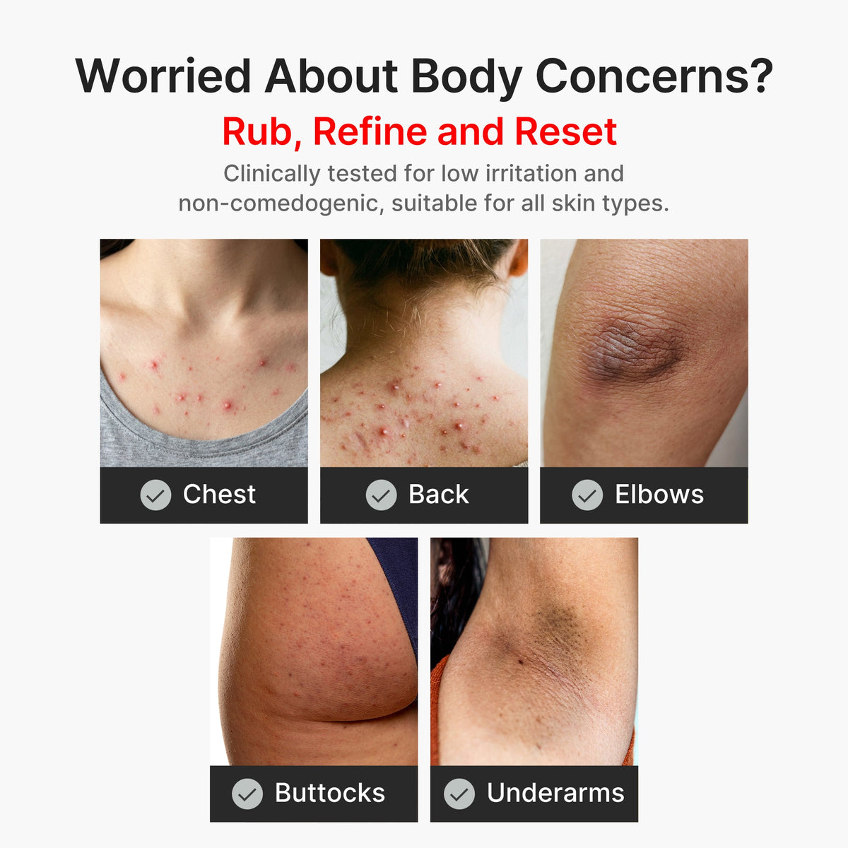 kojic-acid-turmeric-body-peel-shot-p2 04_8a7237f2-3ebf-401e-bd85-54841aeb3efc.jpg