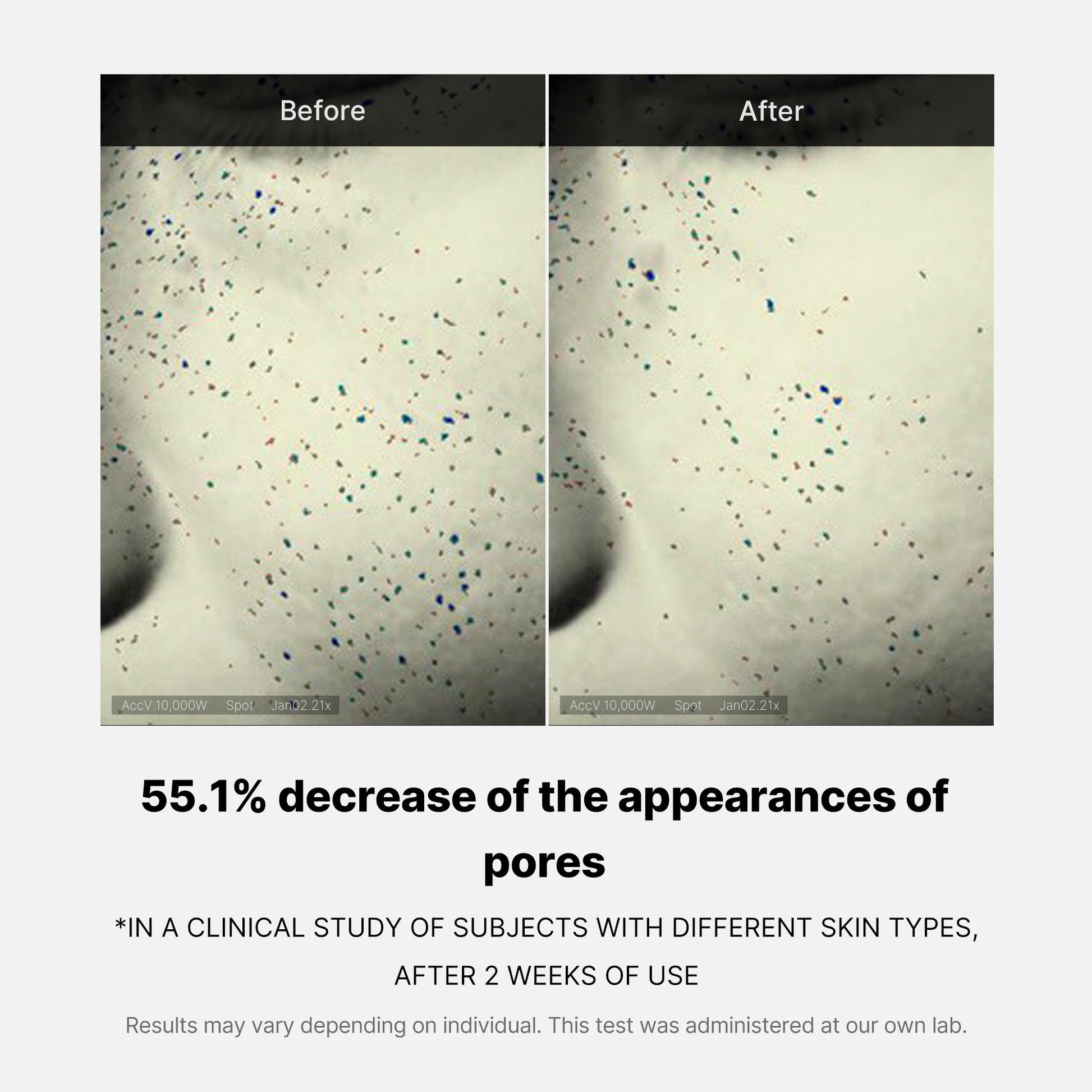 pore-care-duo-q6 05_12ddab8a-64be-4612-8ee1-27e5ec701921.jpg