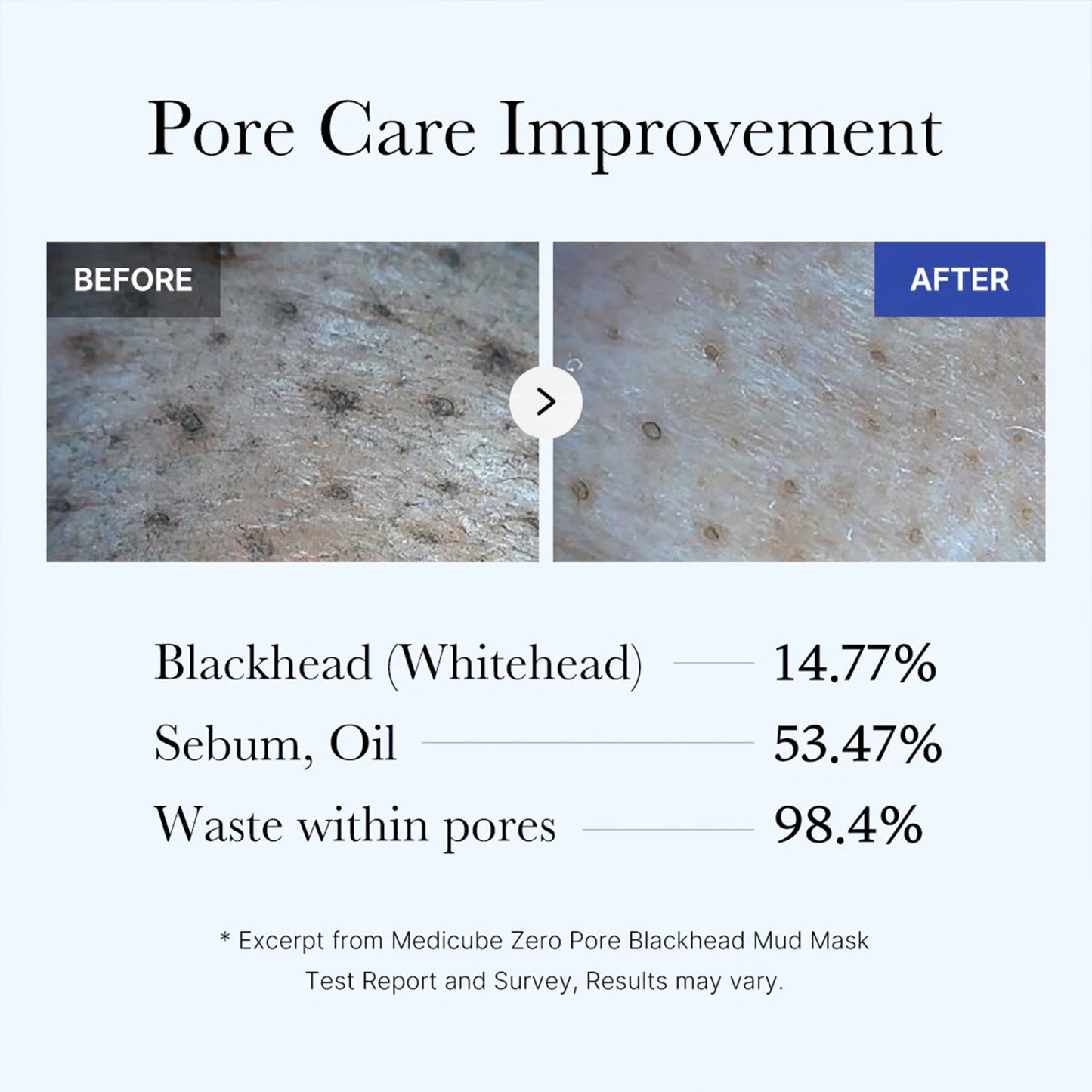 zero-pore-blackhead-mud-mask-p2 05_9362a158-c2b3-4525-acc0-631a2cfdea47.jpg
