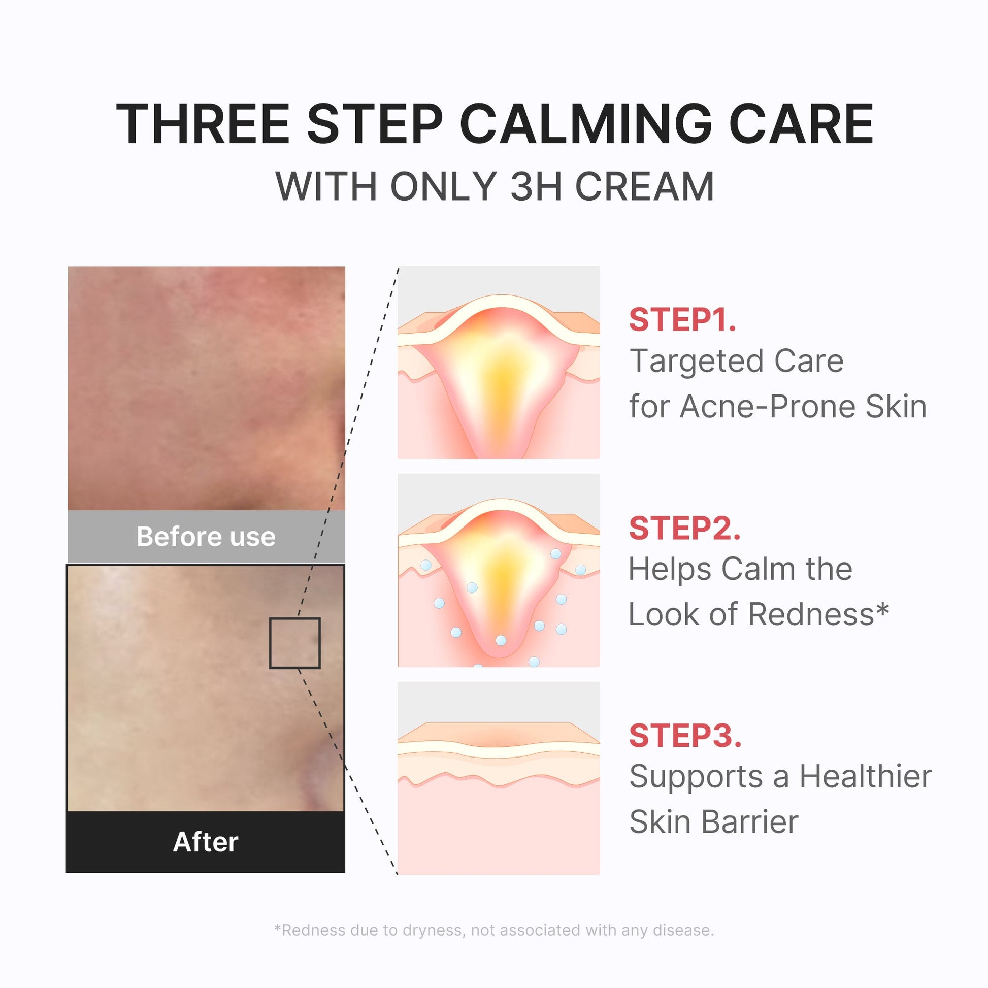 3h-daily-relief-cream-y7 3H_04.jpg