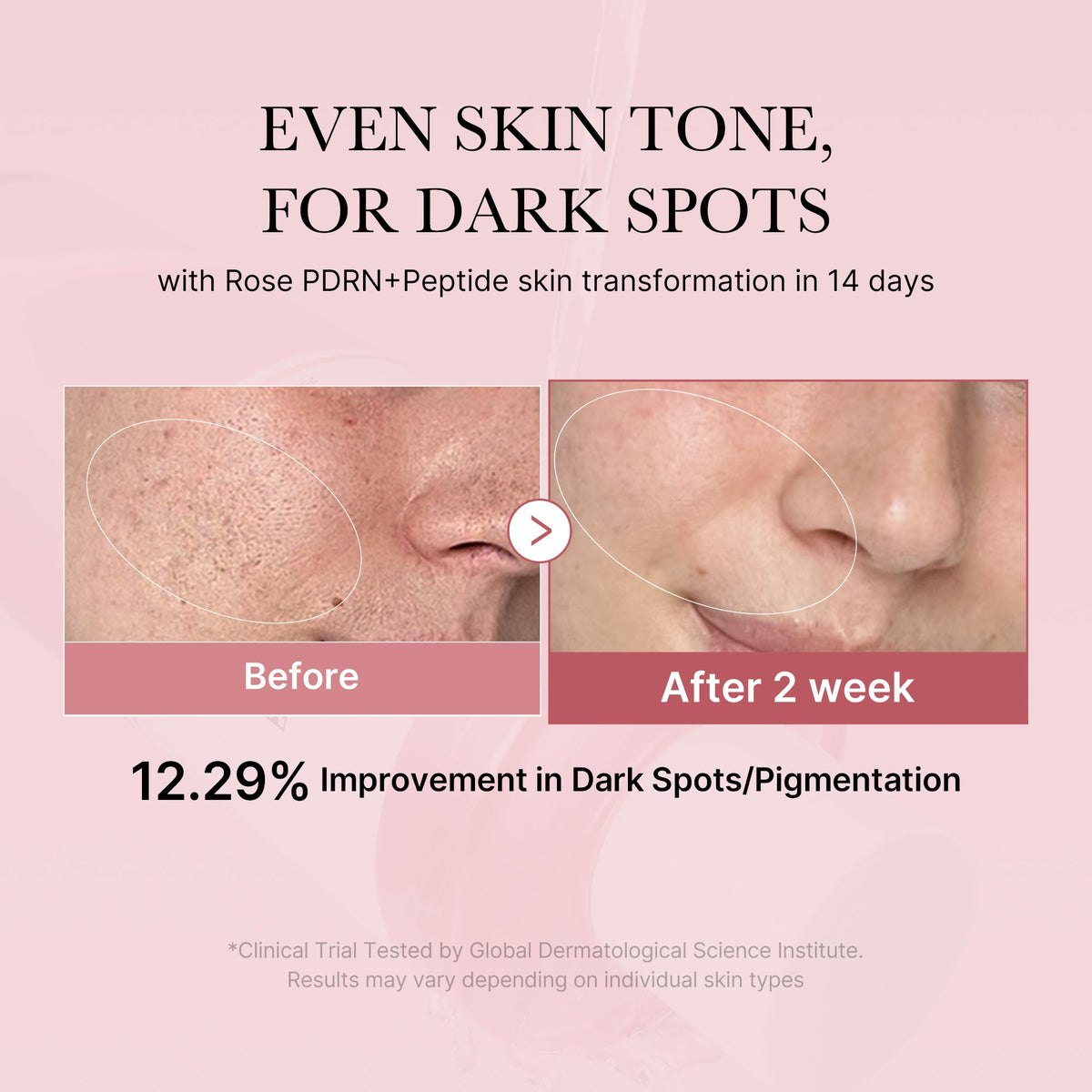 pdrn-pink-peptide-toner-y1 PDRN_01_308c518e-5ac6-4e54-99bd-eabc8796739b.jpg