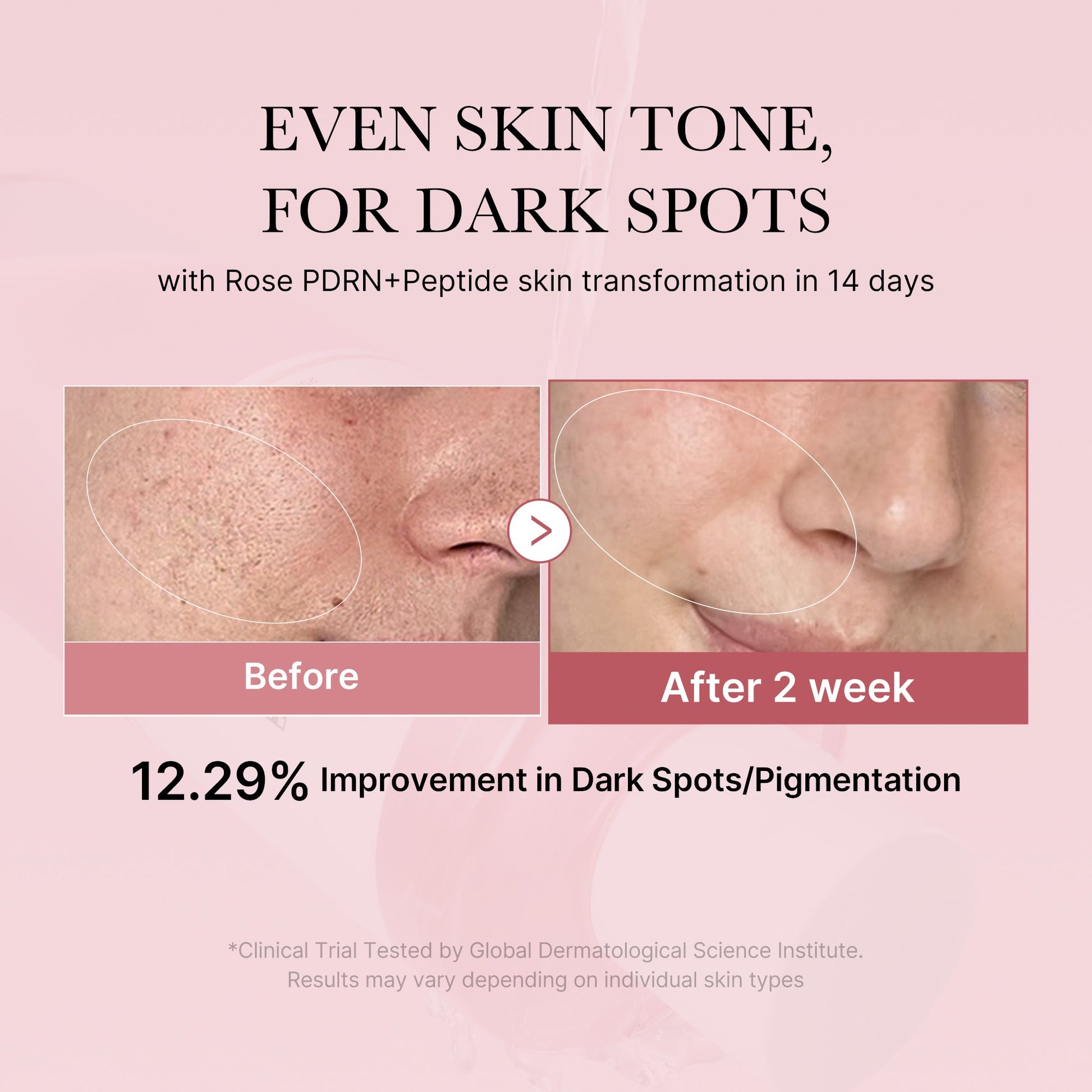 pdrn-pink-peptide-toner-y1 PDRN_01_308c518e-5ac6-4e54-99bd-eabc8796739b.jpg