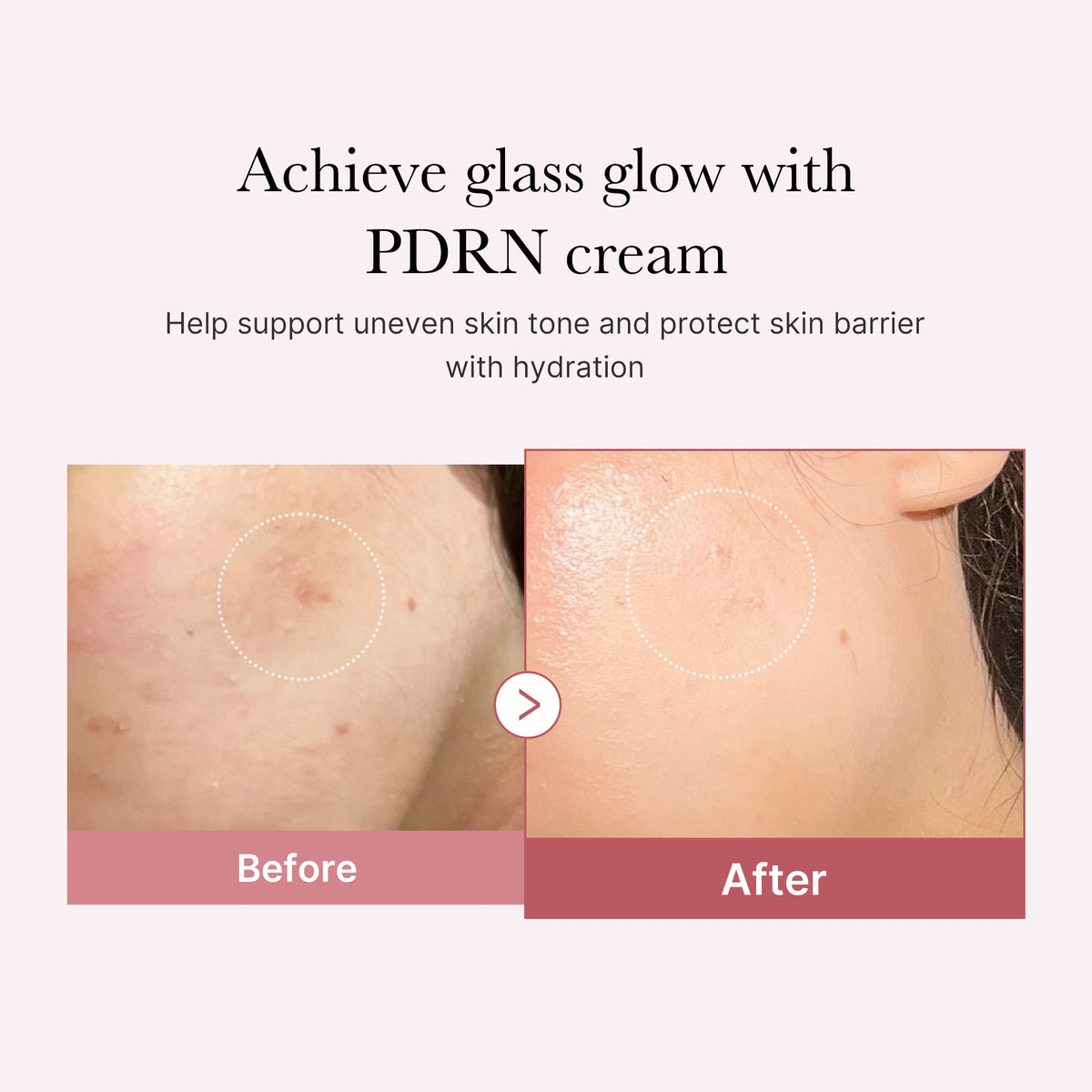 pdrn-pink-peptide-cream-f6 PDRN_02_d7805bfe-cf43-446a-b71b-a276683f136b.jpg