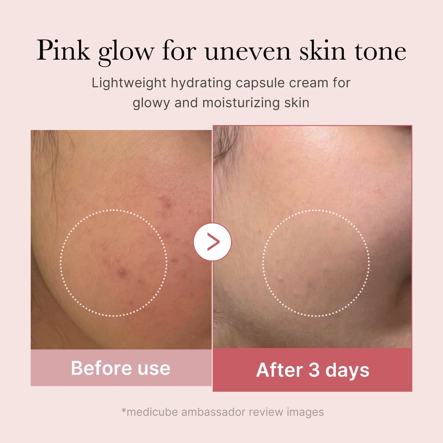 pdrn-pink-collagen-capsule-cream-y5 PDRN_03_058d09d8-4f44-4b1e-927c-e27b1738ae51.jpg