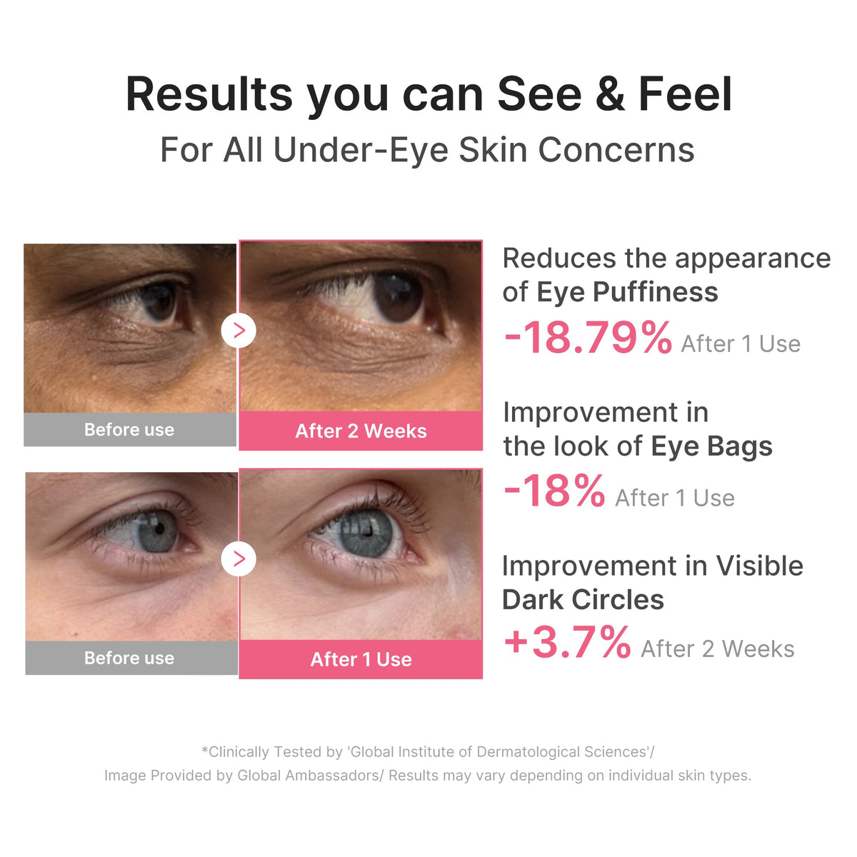 pdrn-caffeine-collagen-eye-patch-r5 PDRN_03_cdce2143-b8d8-43cb-ac69-fcbdf6640249.jpg