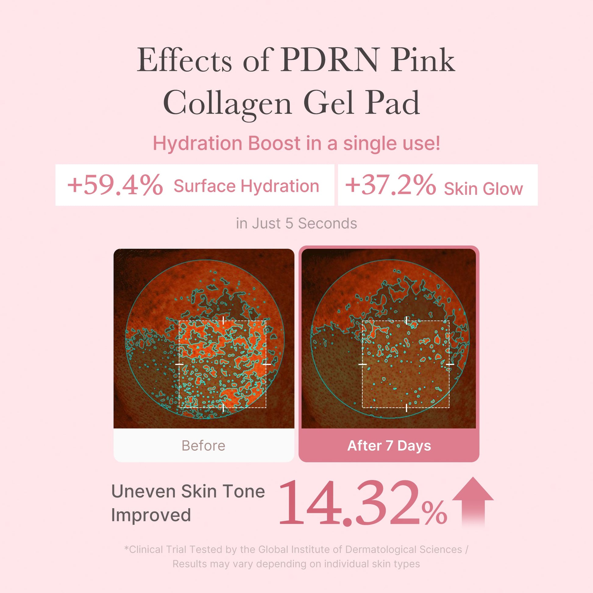 pdrn-pink-collagen-gel-toner-pad-z9 PDRN_04_f9a16a56-8d9e-4c47-a635-ed34ec3ed571.jpg