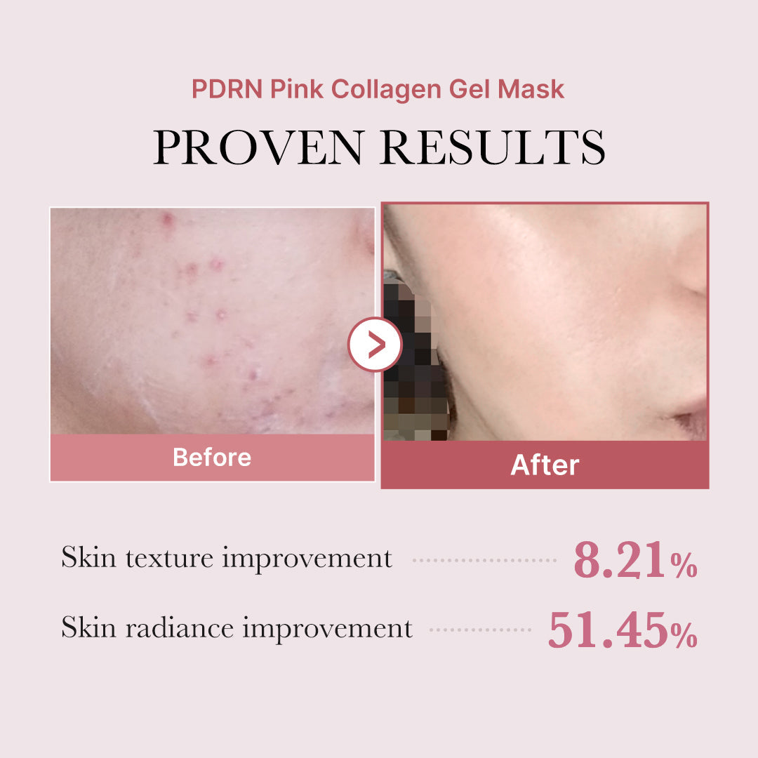 salmon-pdrn-pink-collagen-jelly-gel-mask-r9 PDRN_12.jpg